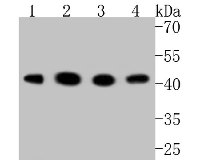 GSK3B Antibody in Western Blot (WB)