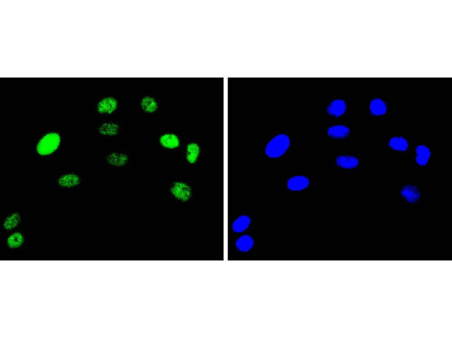 c-Jun Antibody in Immunocytochemistry (ICC/IF)