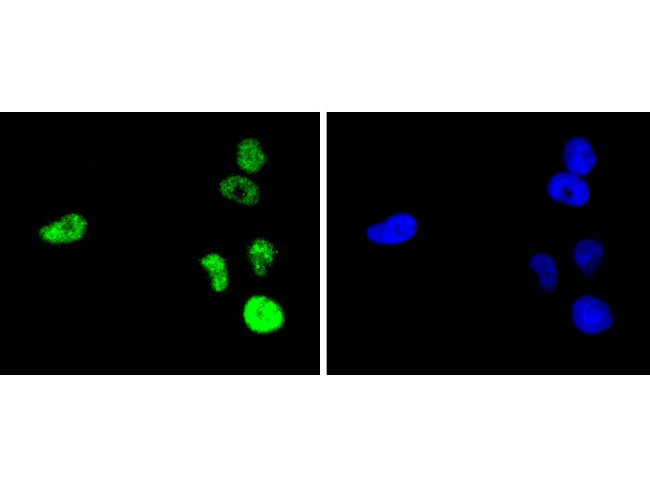 c-Jun Antibody in Immunocytochemistry (ICC/IF)