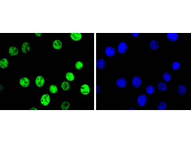 c-Jun Antibody in Immunocytochemistry (ICC/IF)