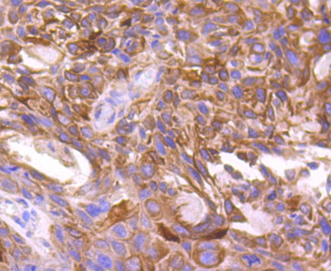 mTOR Antibody in Immunohistochemistry (Paraffin) (IHC (P))