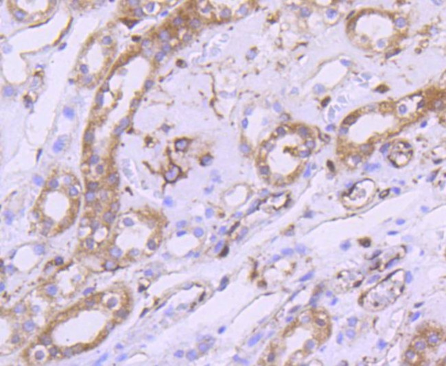 mTOR Antibody in Immunohistochemistry (Paraffin) (IHC (P))