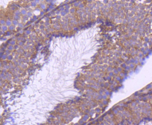 mTOR Antibody in Immunohistochemistry (Paraffin) (IHC (P))