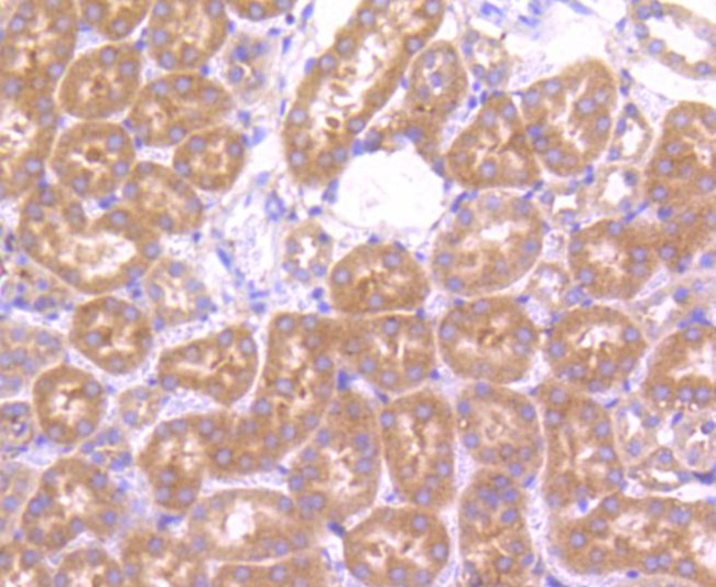 mTOR Antibody in Immunohistochemistry (Paraffin) (IHC (P))