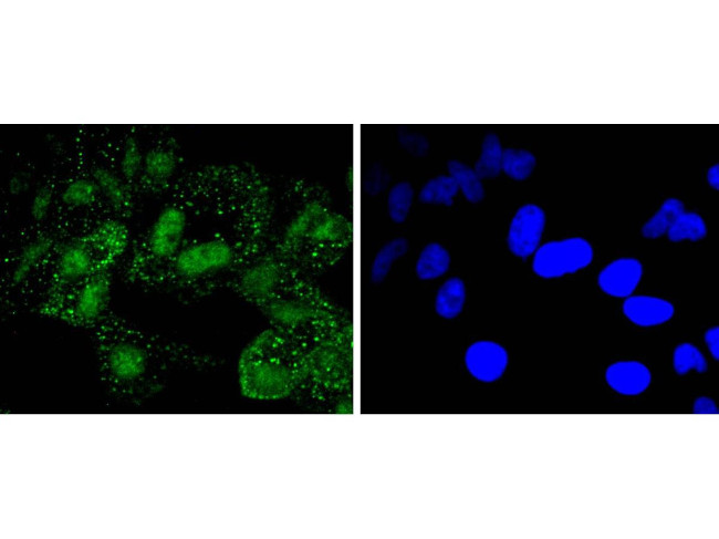 PARP1 Antibody in Immunocytochemistry (ICC/IF)