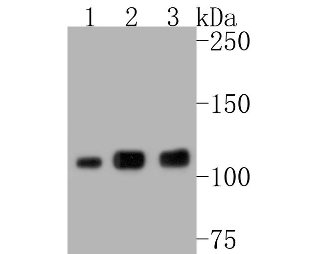 PARP1 Antibody in Western Blot (WB)