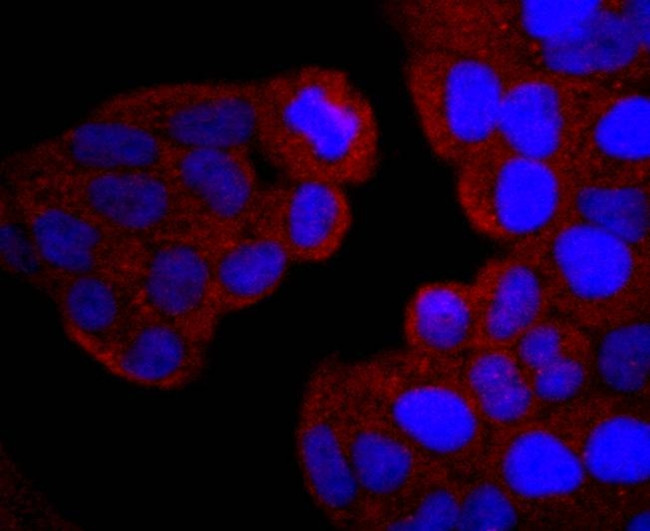 PI3K p85 alpha Antibody in Immunocytochemistry (ICC/IF)