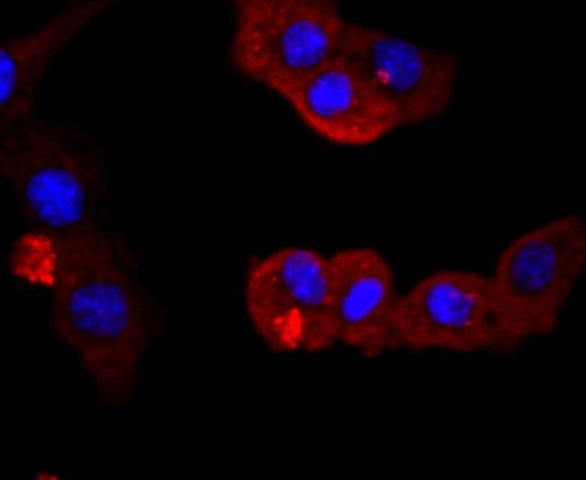 PI3K p85 alpha Antibody in Immunocytochemistry (ICC/IF)