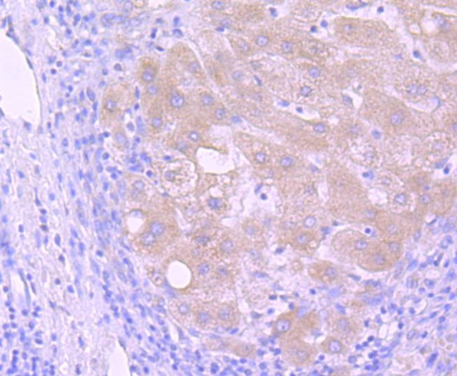 PI3K p85 alpha Antibody in Immunohistochemistry (Paraffin) (IHC (P))