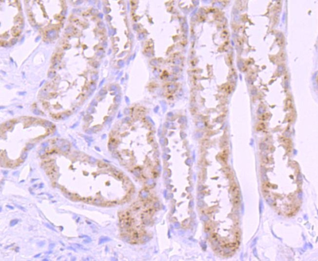 PI3K p85 alpha Antibody in Immunohistochemistry (Paraffin) (IHC (P))