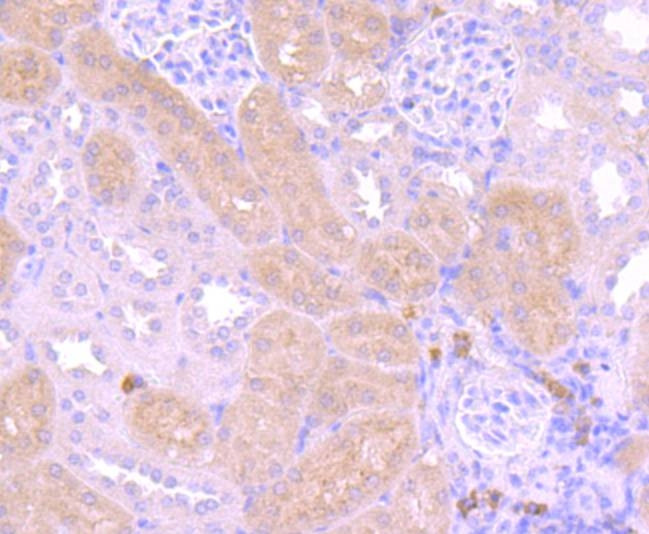 PI3K p85 alpha Antibody in Immunohistochemistry (Paraffin) (IHC (P))