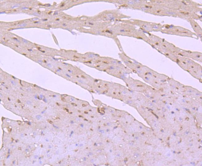 PI3K p85 alpha Antibody in Immunohistochemistry (Paraffin) (IHC (P))