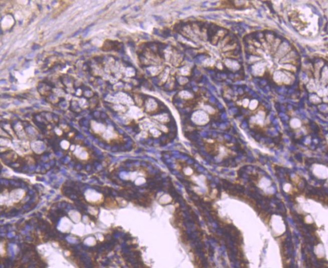 YBX1 Antibody in Immunohistochemistry (Paraffin) (IHC (P))