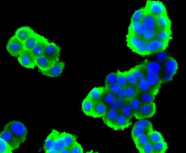 Stathmin 1 Antibody in Immunocytochemistry (ICC/IF)