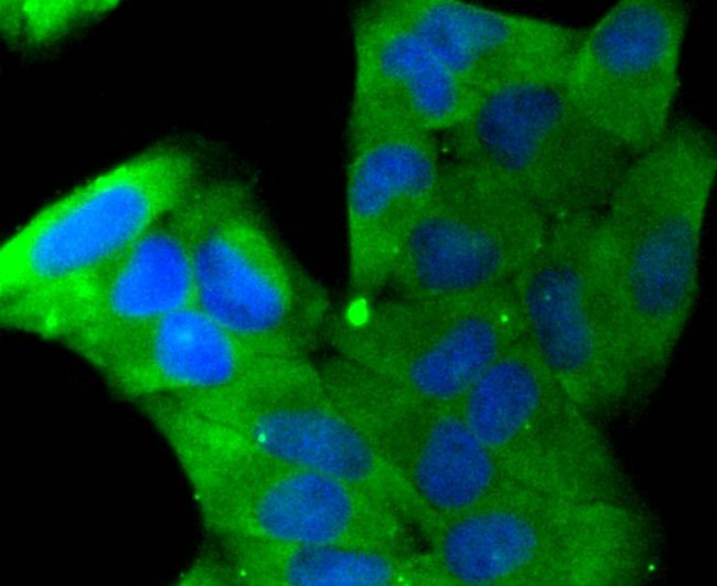 Stathmin 1 Antibody in Immunocytochemistry (ICC/IF)