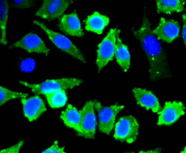 Stathmin 1 Antibody in Immunocytochemistry (ICC/IF)