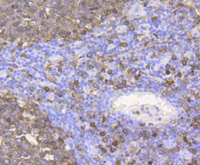 Stathmin 1 Antibody in Immunohistochemistry (Paraffin) (IHC (P))