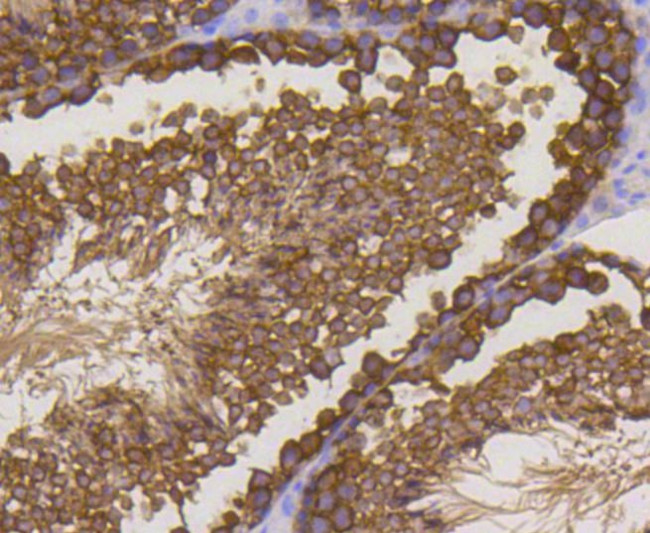 Stathmin 1 Antibody in Immunohistochemistry (Paraffin) (IHC (P))