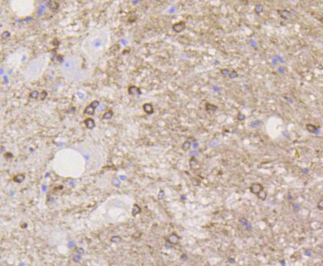 Stathmin 1 Antibody in Immunohistochemistry (Paraffin) (IHC (P))