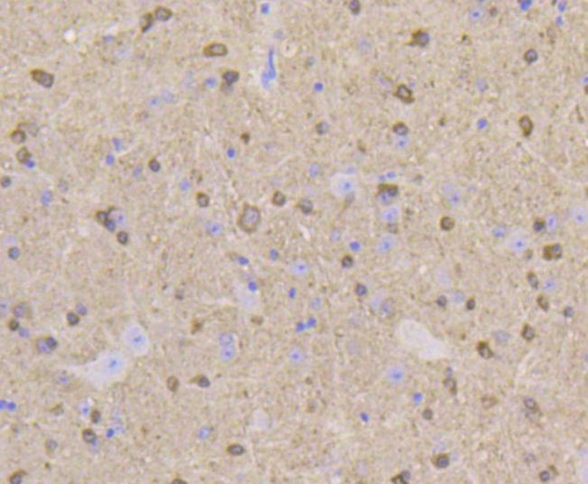 Stathmin 1 Antibody in Immunohistochemistry (Paraffin) (IHC (P))