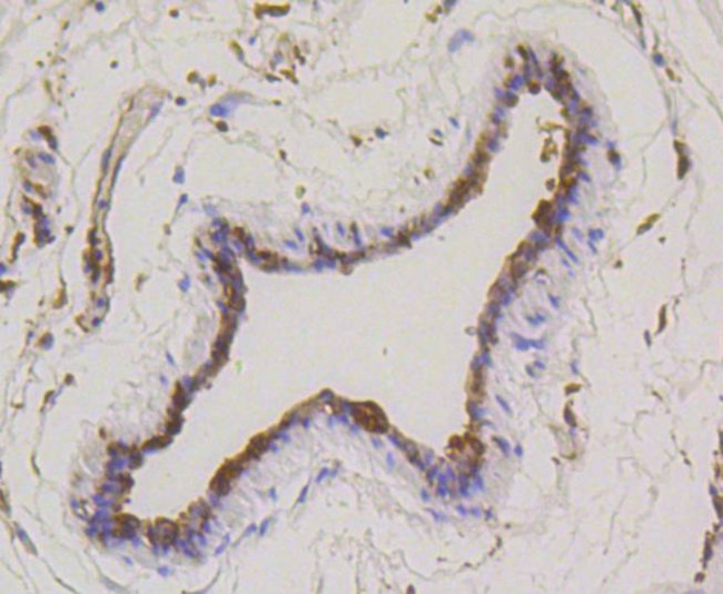 Stathmin 1 Antibody in Immunohistochemistry (Paraffin) (IHC (P))