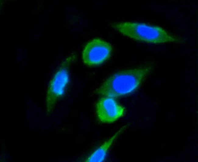 Ubiquitin Antibody in Immunocytochemistry (ICC/IF)