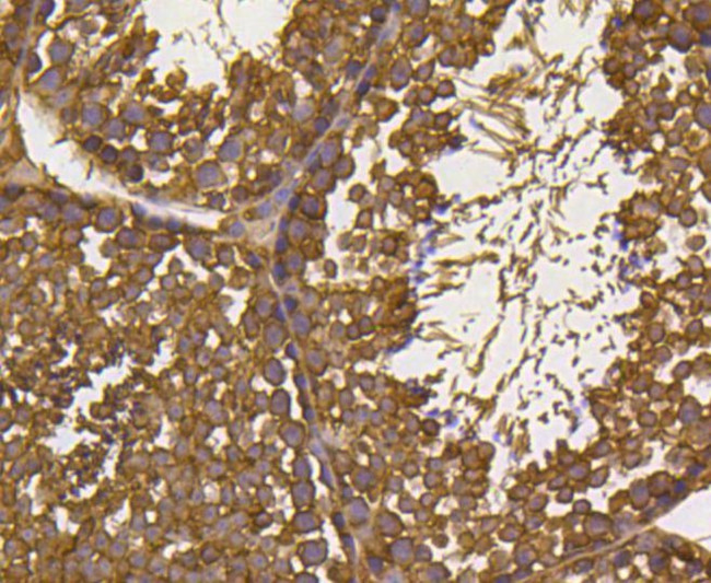 Ubiquitin Antibody in Immunohistochemistry (Paraffin) (IHC (P))