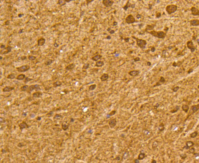 Ubiquitin Antibody in Immunohistochemistry (Paraffin) (IHC (P))