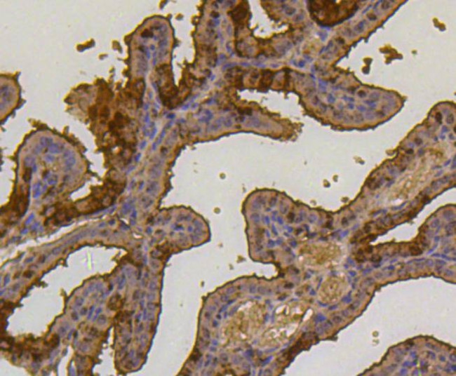 Ubiquitin Antibody in Immunohistochemistry (Paraffin) (IHC (P))