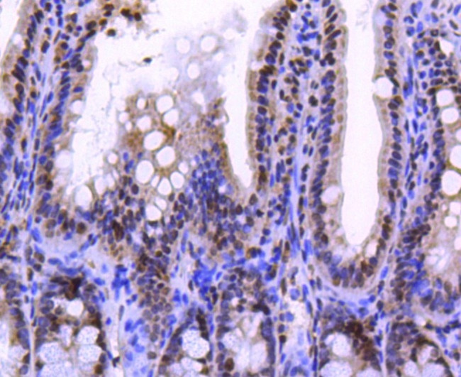 Histone H2A.Z Antibody in Immunohistochemistry (Paraffin) (IHC (P))