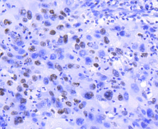 Histone H2A.Z Antibody in Immunohistochemistry (Paraffin) (IHC (P))