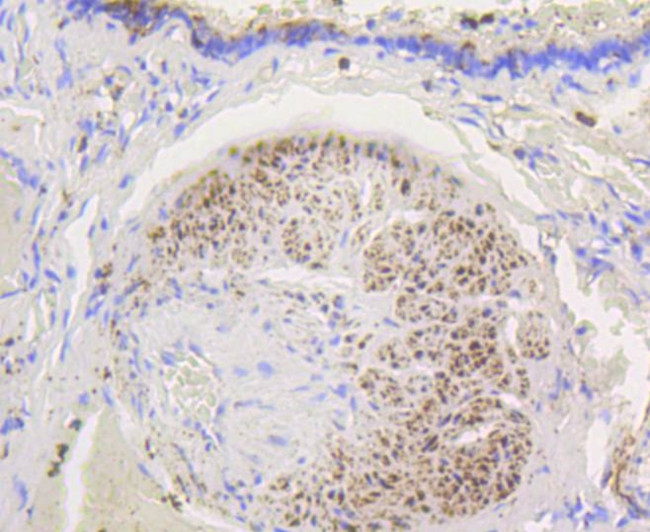 HK1 Antibody in Immunohistochemistry (Paraffin) (IHC (P))