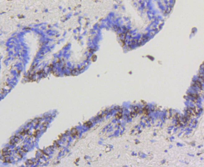 HK1 Antibody in Immunohistochemistry (Paraffin) (IHC (P))