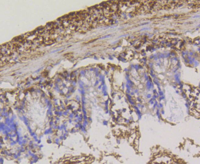 HK1 Antibody in Immunohistochemistry (Paraffin) (IHC (P))