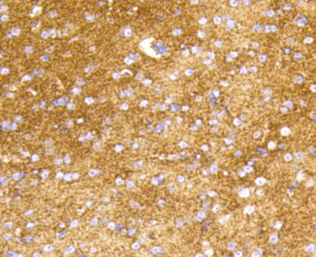 HK1 Antibody in Immunohistochemistry (Paraffin) (IHC (P))