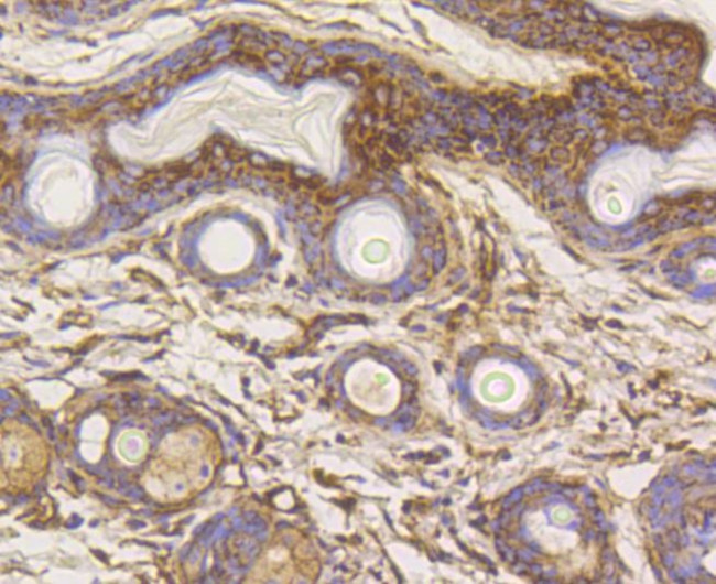 HK1 Antibody in Immunohistochemistry (Paraffin) (IHC (P))