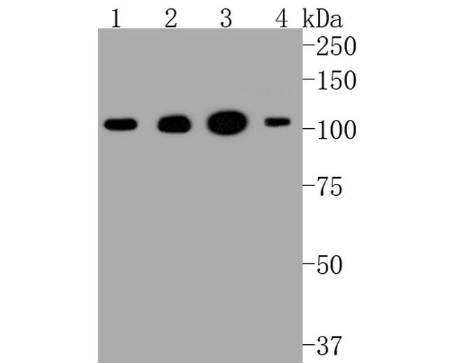 HK1 Antibody in Western Blot (WB)