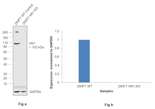 HK1 Antibody in Western Blot (WB)