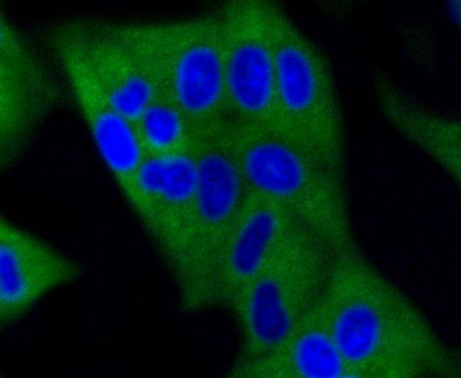 DNMT3A Antibody in Immunocytochemistry (ICC/IF)