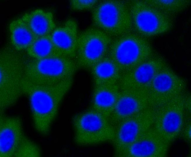 DNMT3A Antibody in Immunocytochemistry (ICC/IF)