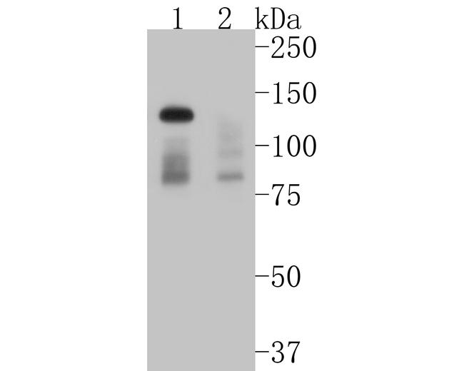 DNMT3A Antibody in Western Blot (WB)