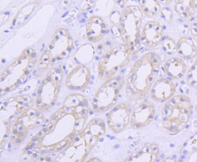 AKT1 Antibody in Immunohistochemistry (Paraffin) (IHC (P))