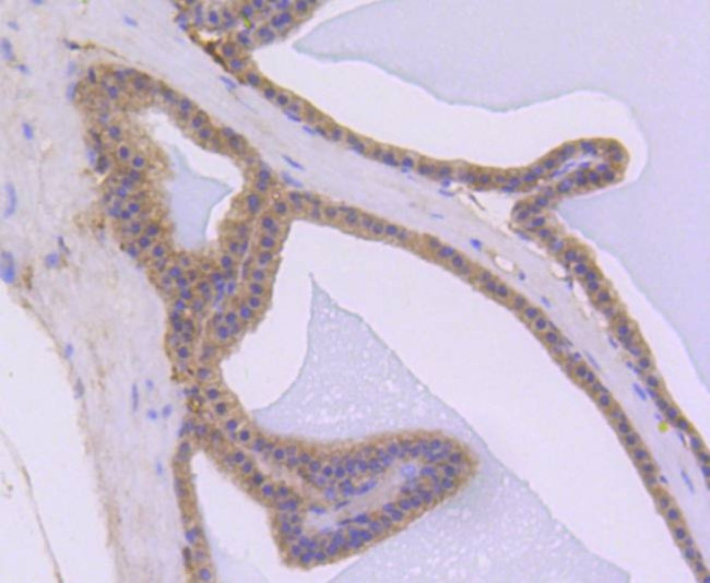 AKT1 Antibody in Immunohistochemistry (Paraffin) (IHC (P))