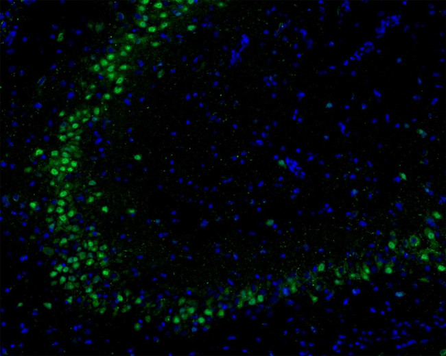 AKT1 Antibody in Immunohistochemistry (Frozen) (IHC (F))