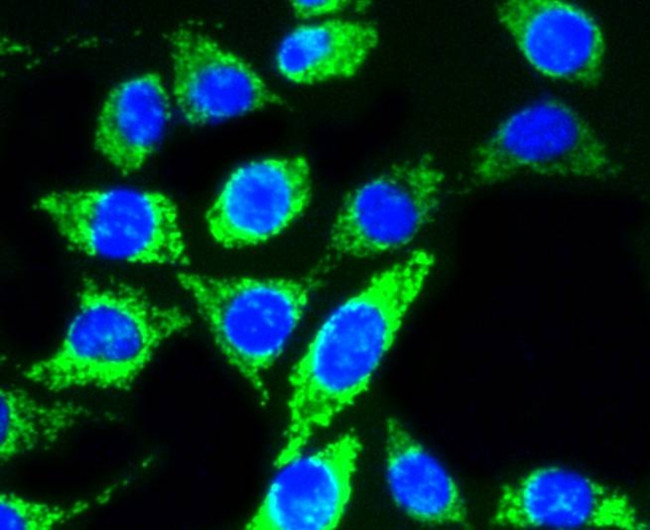 AKT Pan Antibody in Immunocytochemistry (ICC/IF)