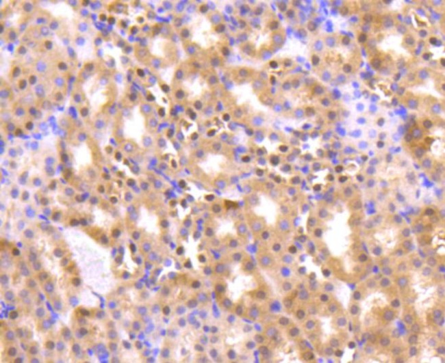 AKT Pan Antibody in Immunohistochemistry (Paraffin) (IHC (P))