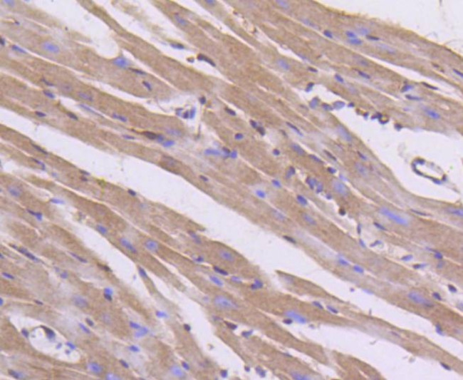 AKT Pan Antibody in Immunohistochemistry (Paraffin) (IHC (P))