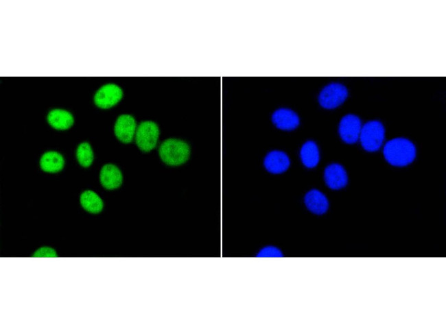 PIM1 Antibody in Immunocytochemistry (ICC/IF)