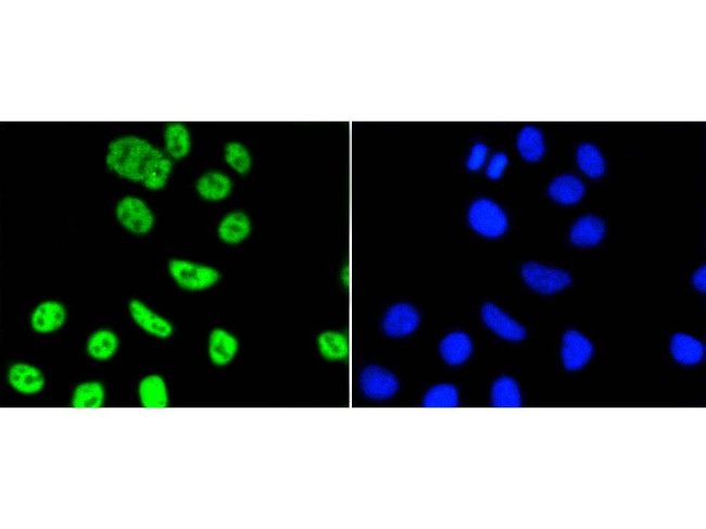 PIM1 Antibody in Immunocytochemistry (ICC/IF)