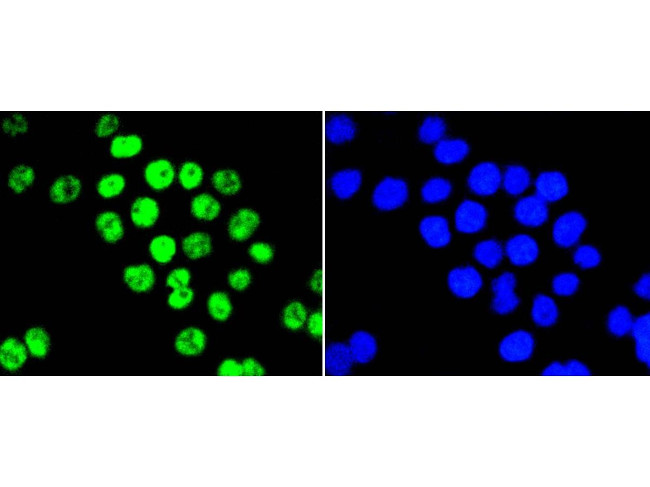 PIM1 Antibody in Immunocytochemistry (ICC/IF)